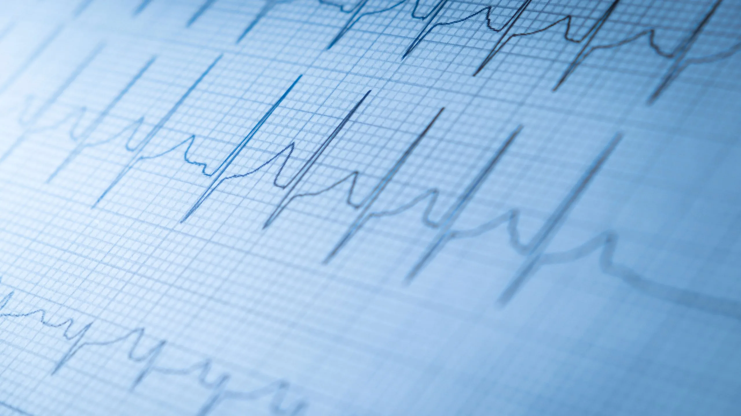 How women's heart health differs from men's 10 How women’s heart health differs from men’s